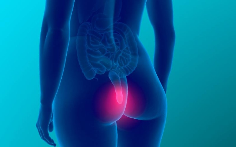 cancer-colorectal-especialista-quito-dr-xavier-obando